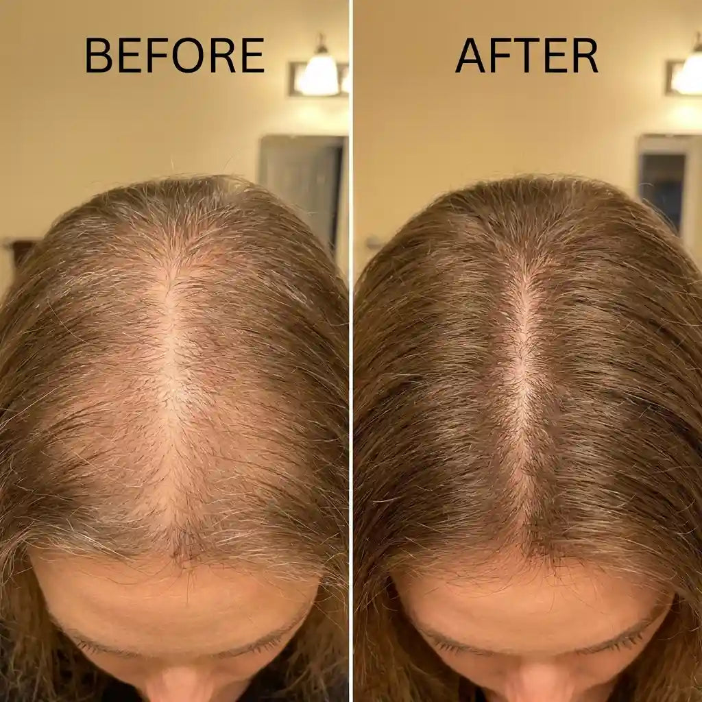 Rebloom Peptide Hair Growth Serum