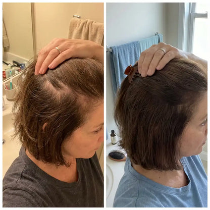 Rebloom Peptide Hair Growth Serum
