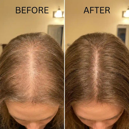 Rebloom Peptide Hair Growth Serum