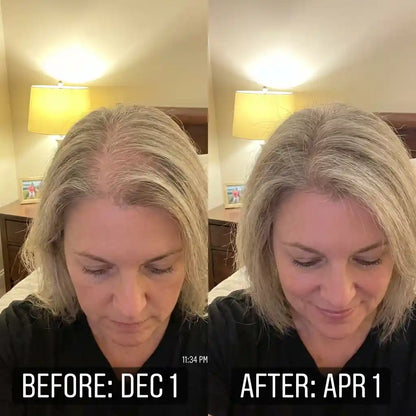 Rebloom Peptide Hair Growth Serum