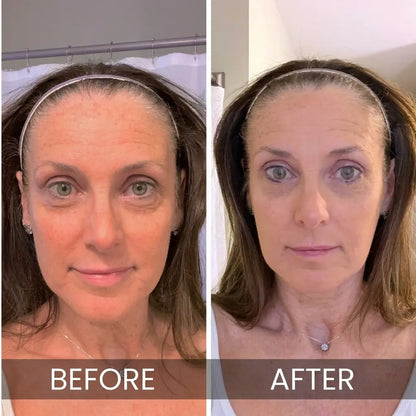 Rebloom - Korean Under-Eye Balm
