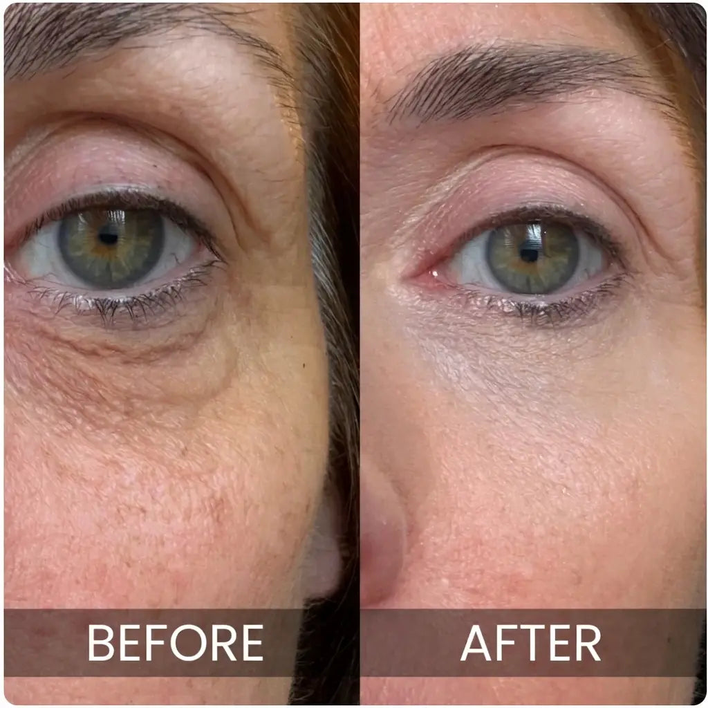 Rebloom - Korean Under-Eye Balm
