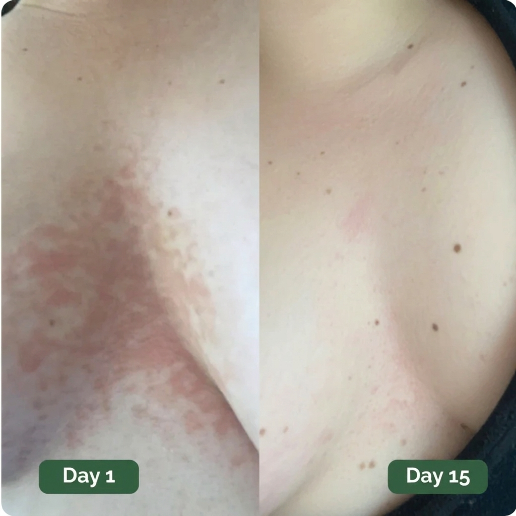 Rebloom Antifungal Soap