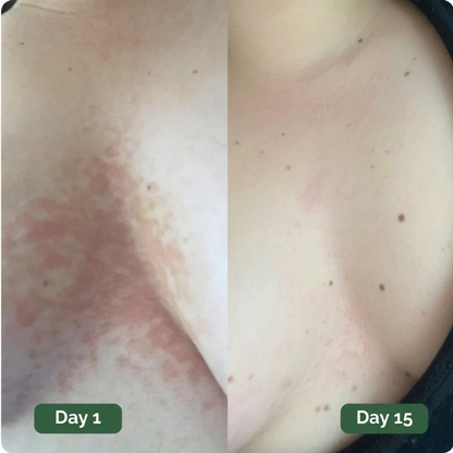 Rebloom Antifungal Soap