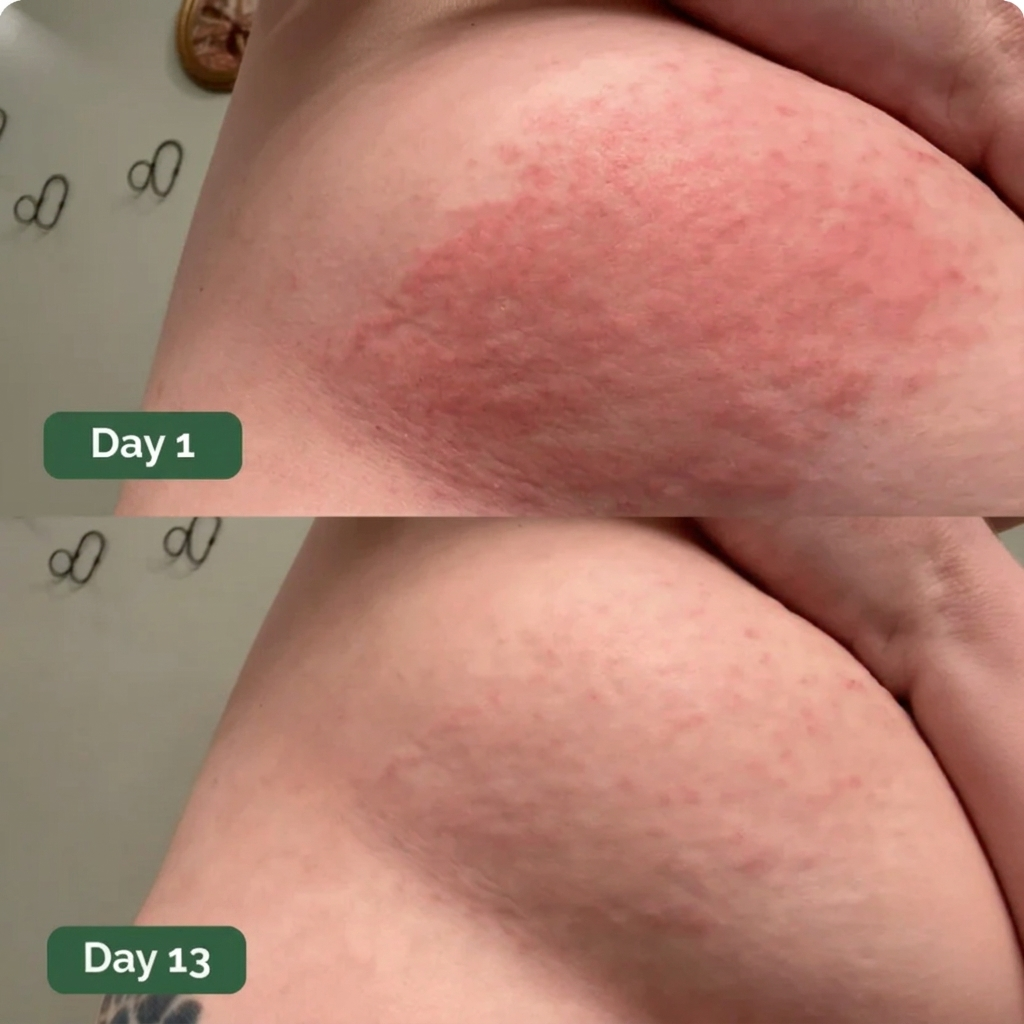 Rebloom Antifungal Soap