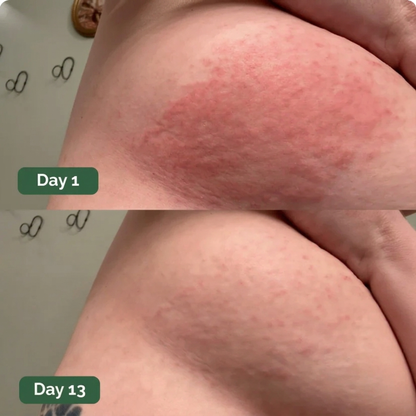 Rebloom Antifungal Soap